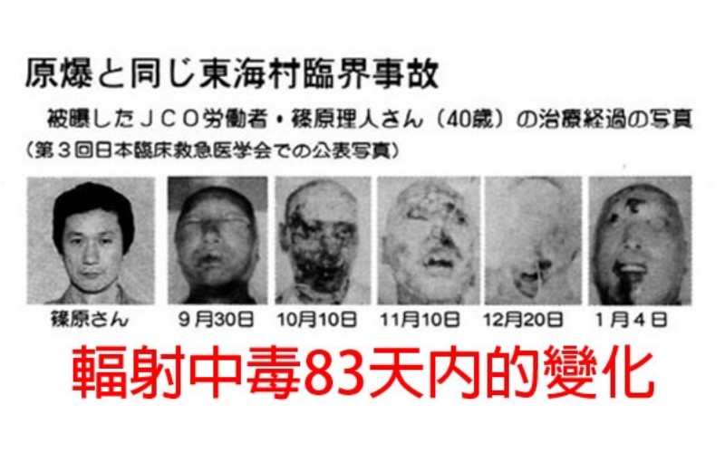 18个政府绝不会向民众承认的「核事故真相」,关於广岛的「鳄鱼人」